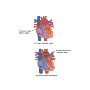 Comprehensive-Treatment-Plan-for-Acquired-Heart-Defects-in-Adults