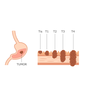 German cancer doctor