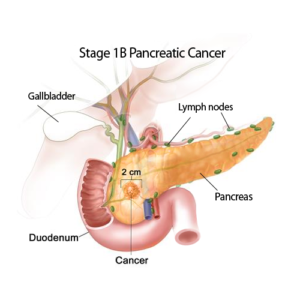 German cancer doctor