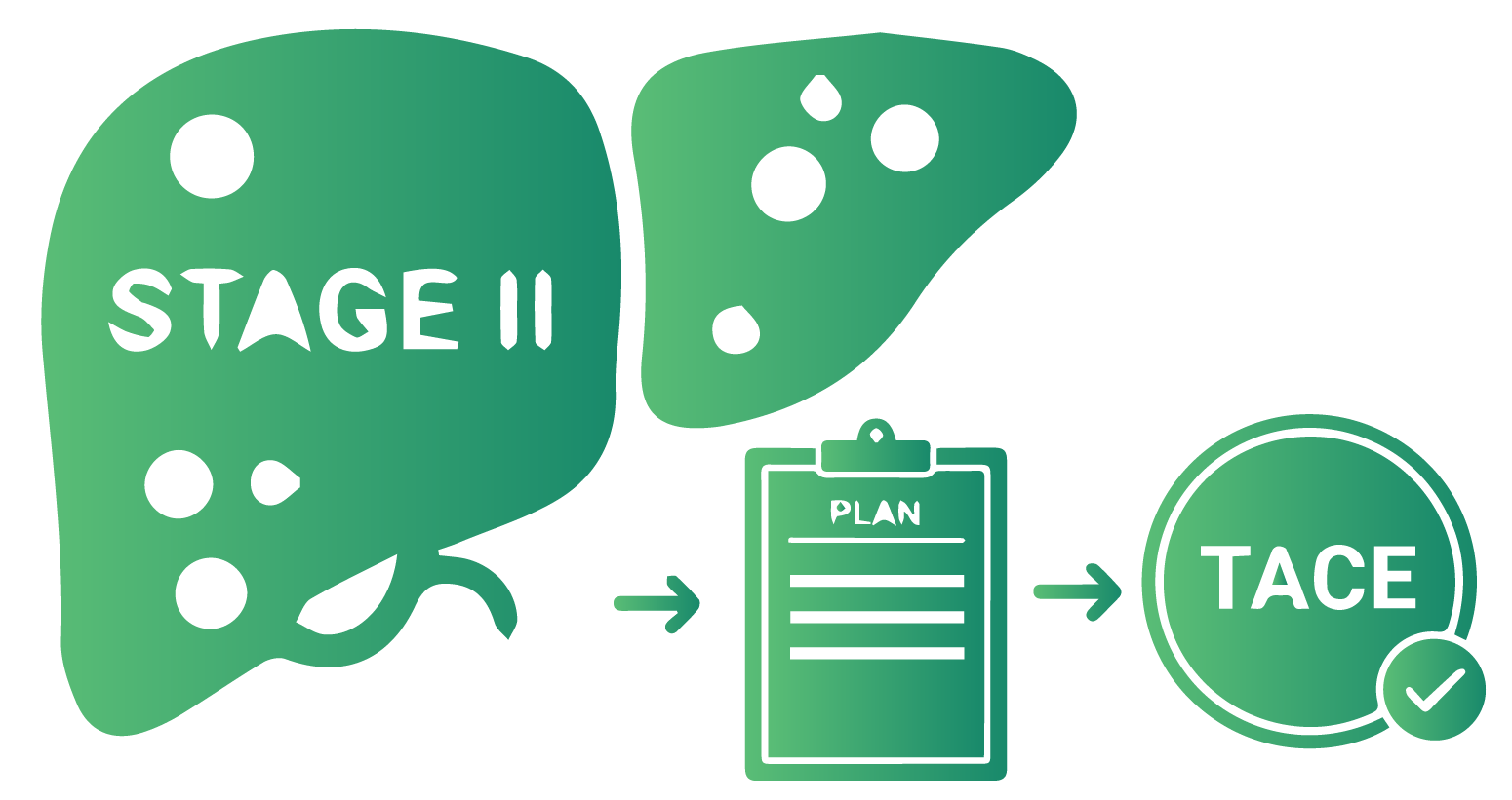 Management Plan for Stage II Liver Cancer – TACE Approach