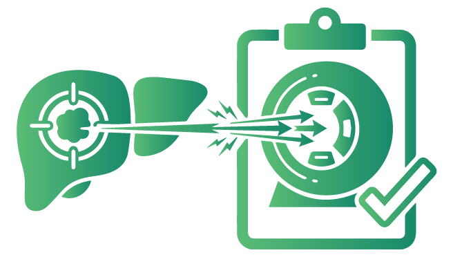 Treatment Plan for Stage II Liver Cancer