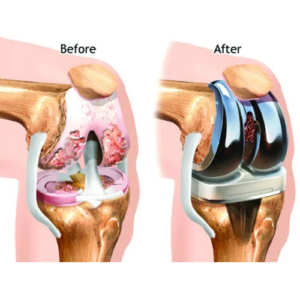 Orthopedic-Surgeries-Types-Definitions-Costs-and-Hospital-Stay-Durations-with-diagram-1.png-prop-3-1