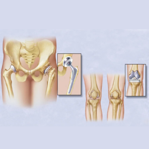 Orthopedic-Surgeries-Types-Definitions-Costs-and-Hospital-Stay-Durations-with-diagram